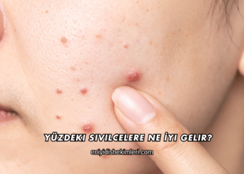 Yüzdeki Sivilcelere Ne İyi Gelir?