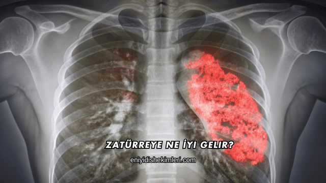 Zatürreye Ne İyi Gelir?