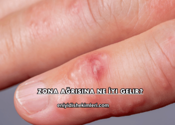 Zona Ağrısına Ne İyi Gelir?