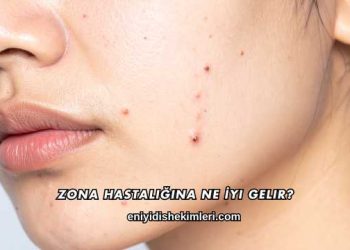 Zona Hastalığına Ne İyi Gelir?