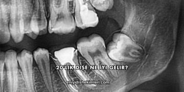 20'lik Dişe Ne İyi Gelir?