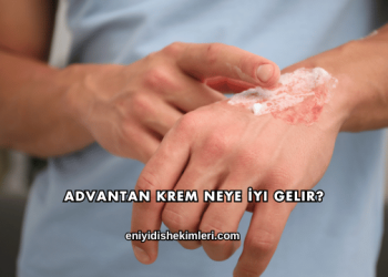Advantan Krem Neye İyi Gelir?