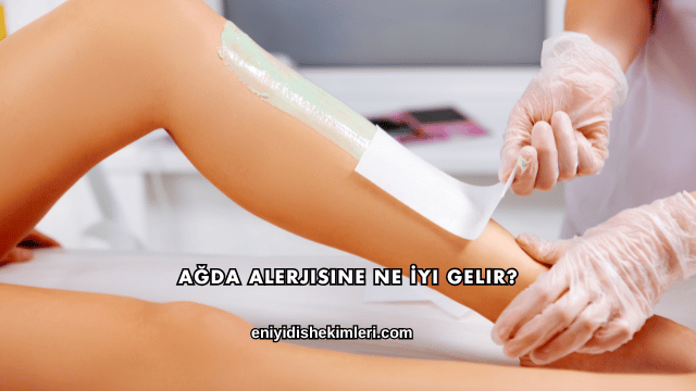 Ağda Alerjisine Ne İyi Gelir?
