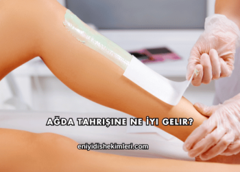 Ağda Tahrişine Ne İyi Gelir?