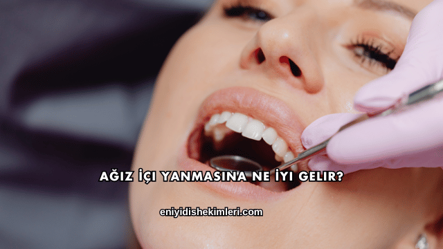 Ağız İçi Yanmasına Ne İyi Gelir?