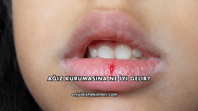 Ağız Kurumasına Ne İyi Gelir?