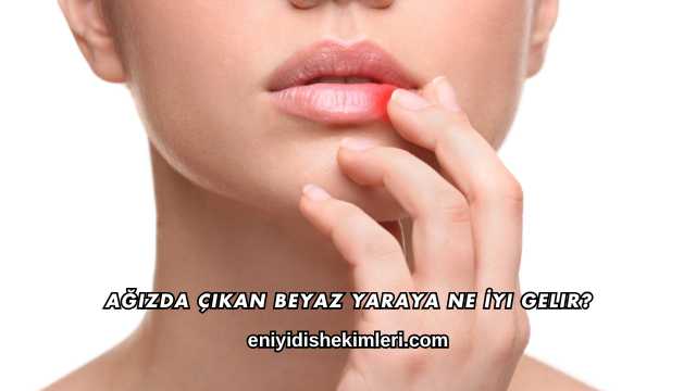 Ağızda Çıkan Beyaz Yaraya Ne İyi Gelir?