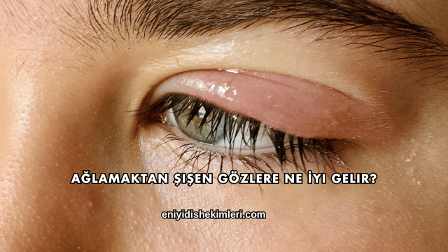 Ağlamaktan Şişen Gözlere Ne İyi Gelir?