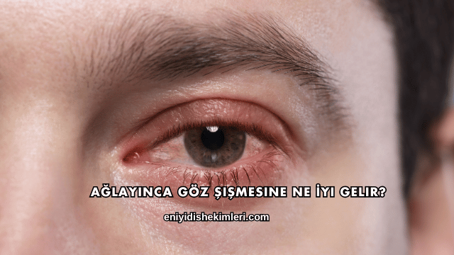 Ağlayınca Göz Şişmesine Ne İyi Gelir?