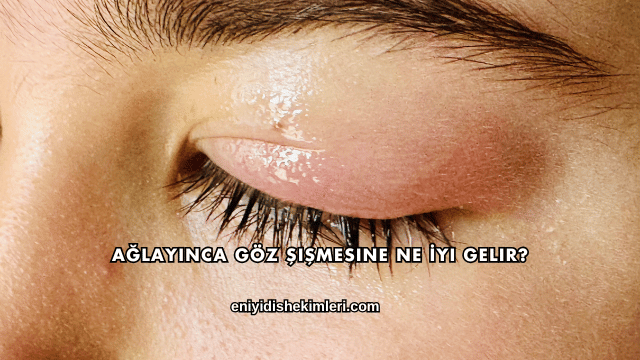 Ağlayınca Göz Şişmesine Ne İyi Gelir?