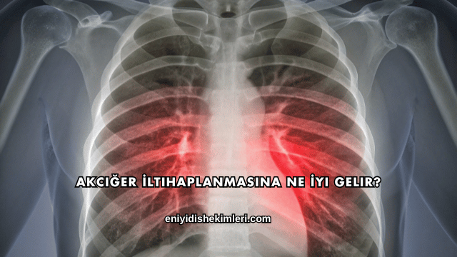 Akciğer İltihaplanmasına Ne İyi Gelir?