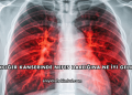 Akciğer Kanserinde Nefes Darlığına Ne İyi Gelir?