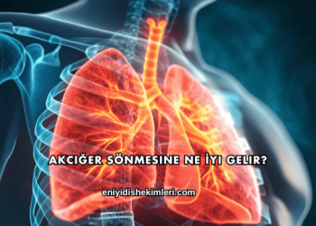 Akciğer Sönmesine Ne İyi Gelir?