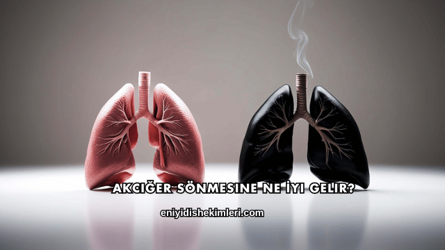 Akciğer Sönmesine Ne İyi Gelir?