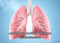 Akciğerdeki Nodüle Ne İyi Gelir?