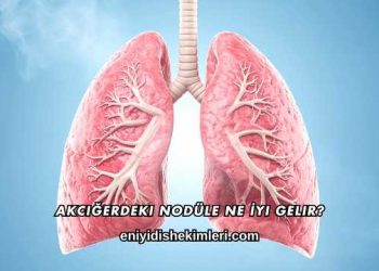 Akciğerdeki Nodüle Ne İyi Gelir?