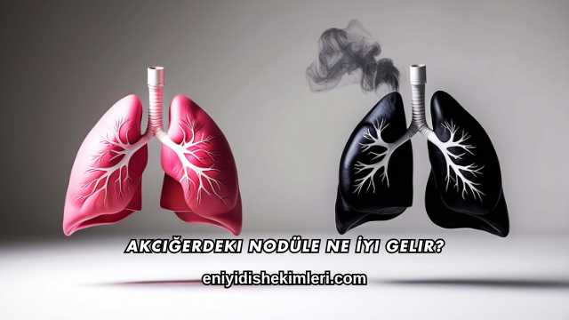 Akciğerdeki Nodüle Ne İyi Gelir?