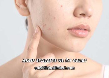 Aktif Sivilceye Ne İyi Gelir?