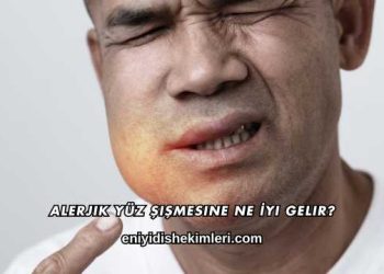 Alerjik Yüz Şişmesine Ne İyi Gelir?