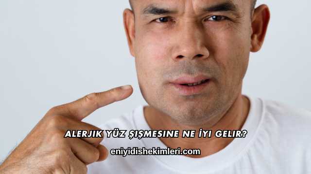 Alerjik Yüz Şişmesine Ne İyi Gelir?