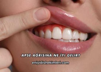 Apse Ağrısına Ne İyi Gelir?