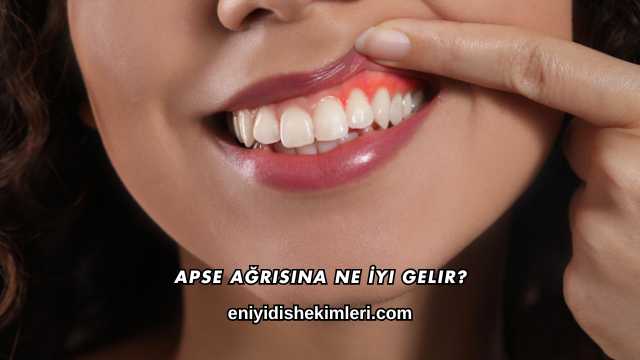 Apse Ağrısına Ne İyi Gelir?