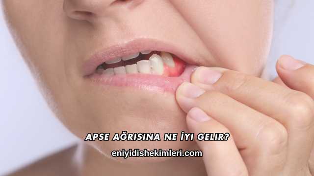 Apse Ağrısına Ne İyi Gelir?