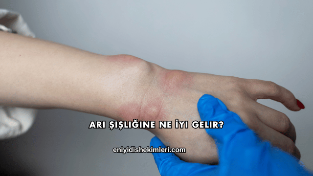 Arı Şişliğine Ne İyi Gelir?