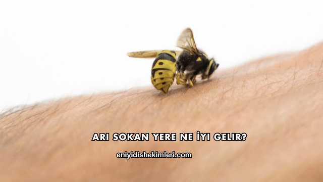 Arı Sokan Yere Ne İyi Gelir?