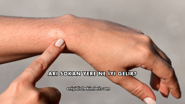 Arı Sokan Yere Ne İyi Gelir?