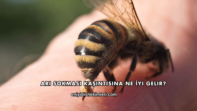 Arı Sokması Kaşıntısına Ne İyi Gelir?