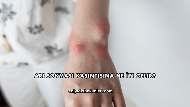 Arı Sokması Kaşıntısına Ne İyi Gelir?