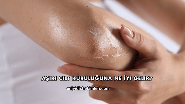 Aşırı Cilt Kuruluğuna Ne İyi Gelir?