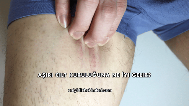 Aşırı Cilt Kuruluğuna Ne İyi Gelir?