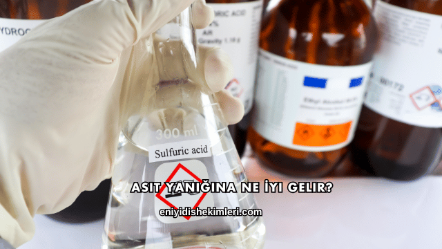 Asit Yanığına Ne İyi Gelir?