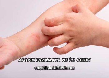 Atopik Egzamaya Ne İyi Gelir?