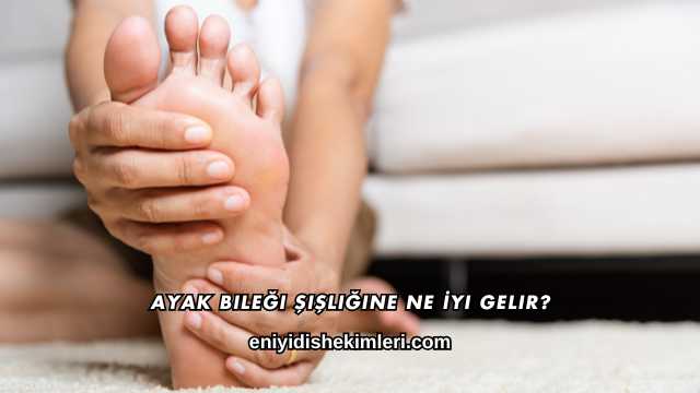 Ayak Bileği Şişliğine Ne İyi Gelir?