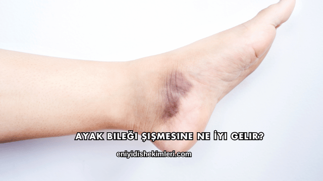 Ayak Bileği Şişmesine Ne İyi Gelir?