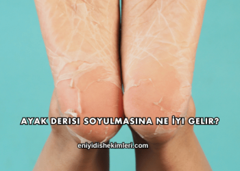 Ayak Derisi Soyulmasına Ne İyi Gelir?