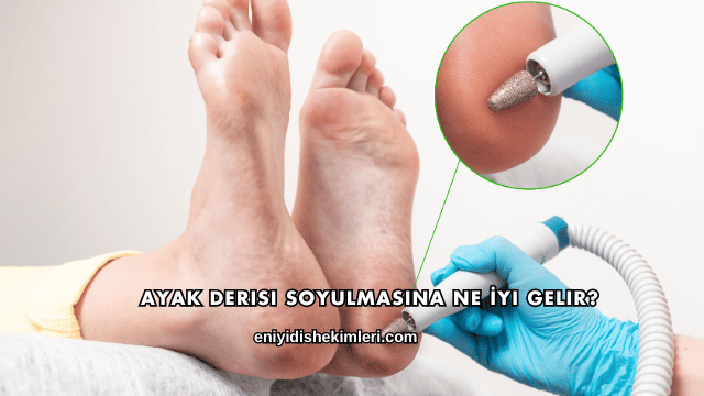 Ayak Derisi Soyulmasına Ne İyi Gelir?