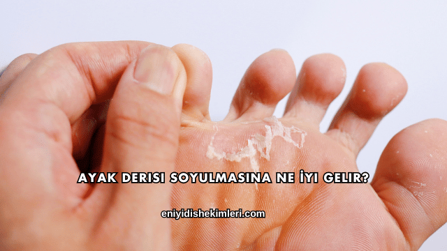 Ayak Derisi Soyulmasına Ne İyi Gelir?