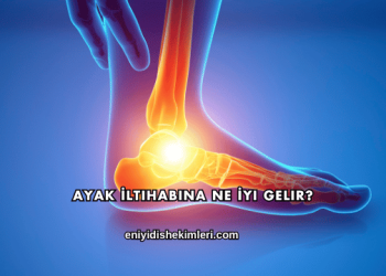 Ayak İltihabına Ne İyi Gelir?