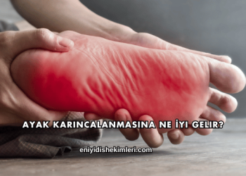Ayak Karıncalanmasına Ne İyi Gelir?