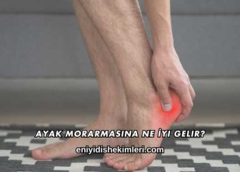 Ayak Morarmasına Ne İyi Gelir?