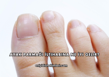 Ayak Parmağı İltihabına Ne İyi Gelir?