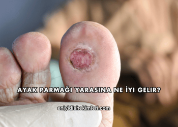 Ayak Parmağı Yarasına Ne İyi Gelir?