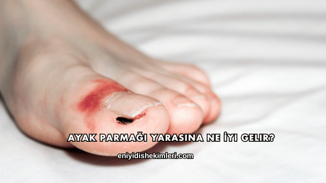 Ayak Parmağı Yarasına Ne İyi Gelir?