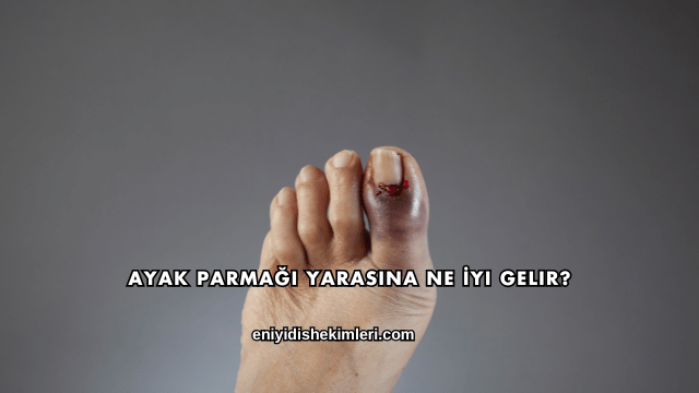 Ayak Parmağı Yarasına Ne İyi Gelir?
