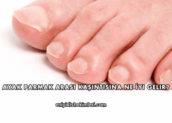 Ayak Parmak Arası Kaşıntısına Ne İyi Gelir?