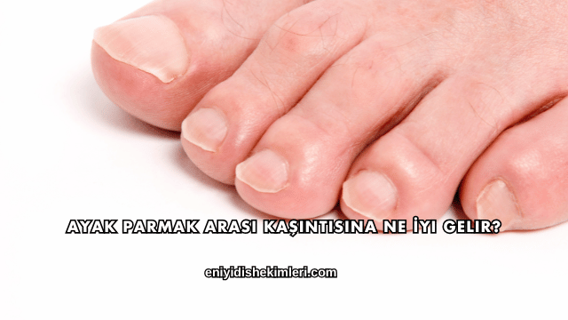 Ayak Parmak Arası Kaşıntısına Ne İyi Gelir?